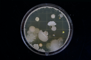 Lees meer over het artikel Pseudomonas aeruginosa: alles wat je hierover moet weten